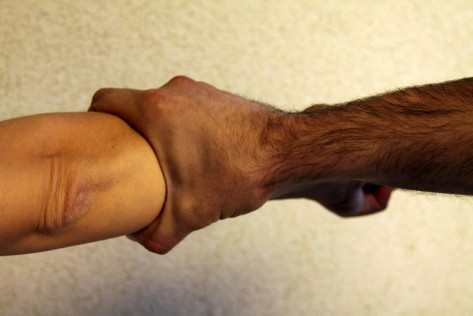 Nasilje (Foto: Žeminea Čotrić)